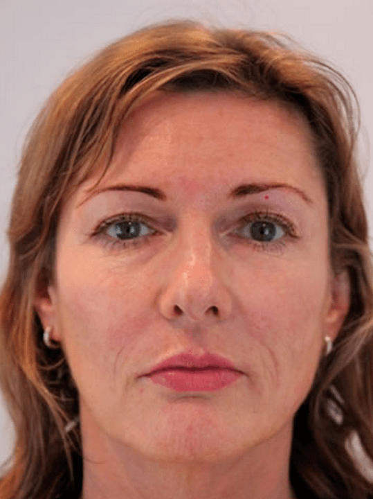 Mă simt mai tânăr după cursul Eudalie